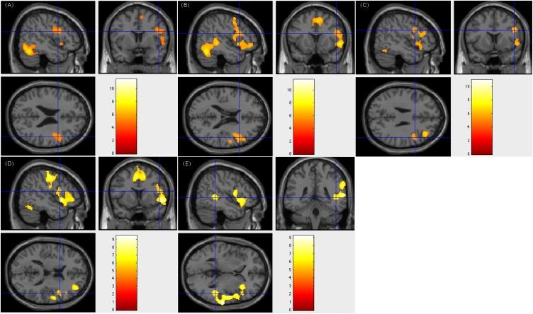 https://cdn.ncbi.nlm.nih.gov/pmc/blobs/7f41/6560162/0b62d596123d/fnhum-13-00183-g001.jpg