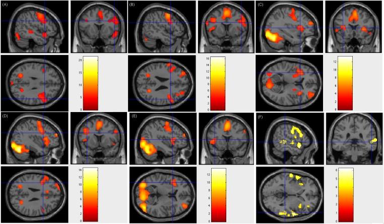 https://cdn.ncbi.nlm.nih.gov/pmc/blobs/7f41/6560162/adfa38ce2c19/fnhum-13-00183-g004.jpg