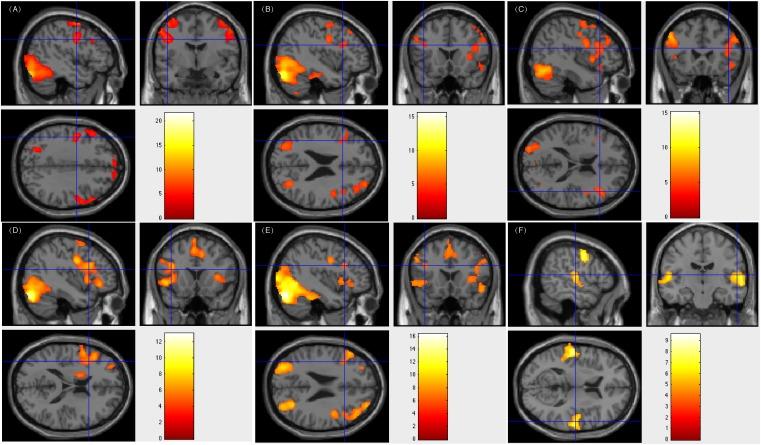 https://cdn.ncbi.nlm.nih.gov/pmc/blobs/7f41/6560162/f787a10eefe8/fnhum-13-00183-g003.jpg