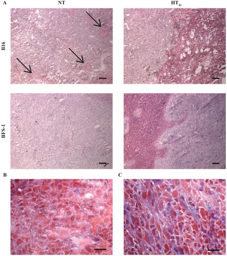 https://cdn.ncbi.nlm.nih.gov/pmc/blobs/7f4b/4955068/84e21f4a987b/thnov06p1717g008.jpg
