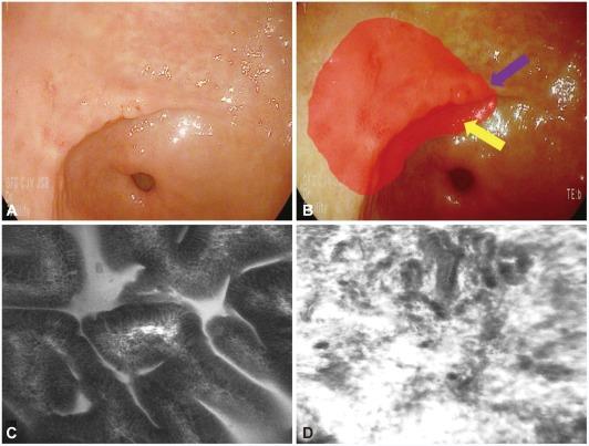 https://cdn.ncbi.nlm.nih.gov/pmc/blobs/7f63/3363066/48efe350feb8/ce-44-65-g011.jpg