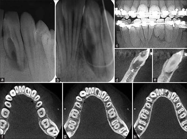 https://cdn.ncbi.nlm.nih.gov/pmc/blobs/7f6b/5514813/9fdcc05125b9/JCD-20-58-g001.jpg