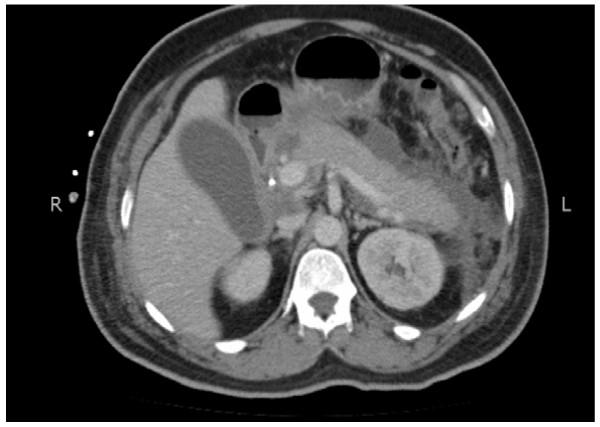 https://cdn.ncbi.nlm.nih.gov/pmc/blobs/7f6f/3423052/5c2522fb7785/1752-1947-6-157-2.jpg