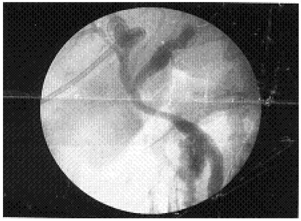 https://cdn.ncbi.nlm.nih.gov/pmc/blobs/7f6f/3423052/dc8c82c8e82e/1752-1947-6-157-4.jpg