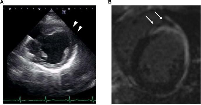 https://cdn.ncbi.nlm.nih.gov/pmc/blobs/7f77/5436767/1040dca7d560/imcrj-10-167Fig2.jpg