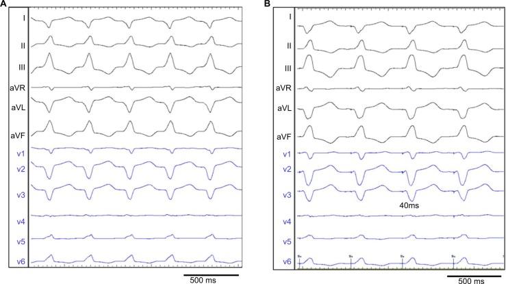 https://cdn.ncbi.nlm.nih.gov/pmc/blobs/7f77/5436767/2662137dfed9/imcrj-10-167Fig1.jpg