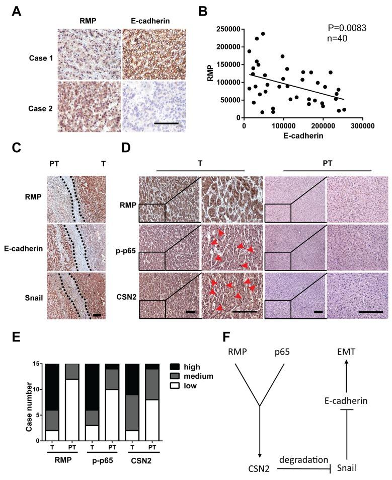 https://cdn.ncbi.nlm.nih.gov/pmc/blobs/7f7a/5522250/5ec4597e08a3/oncotarget-08-40373-g007.jpg
