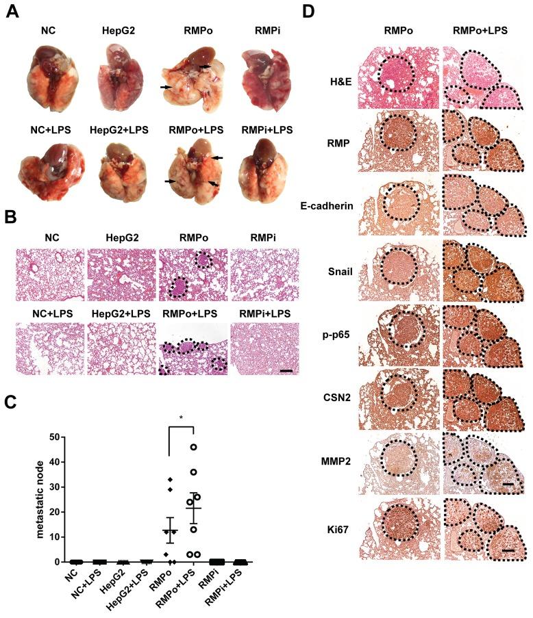 https://cdn.ncbi.nlm.nih.gov/pmc/blobs/7f7a/5522250/ce6692ad8c12/oncotarget-08-40373-g006.jpg