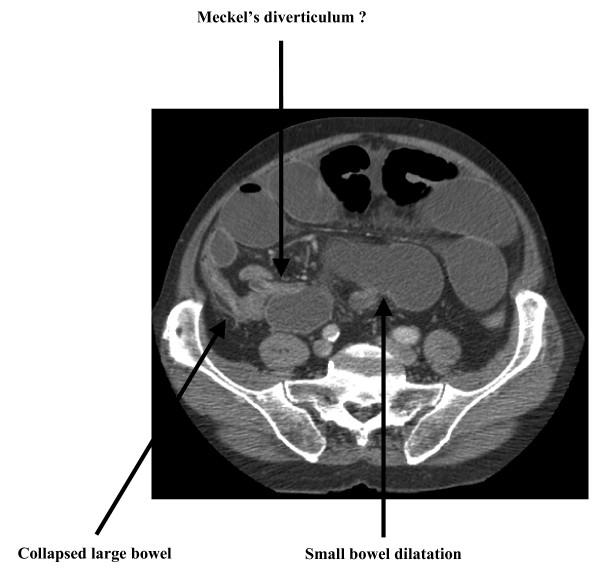 https://cdn.ncbi.nlm.nih.gov/pmc/blobs/7f7d/1847829/8c8032eb3a5c/1752-1947-1-8-2.jpg