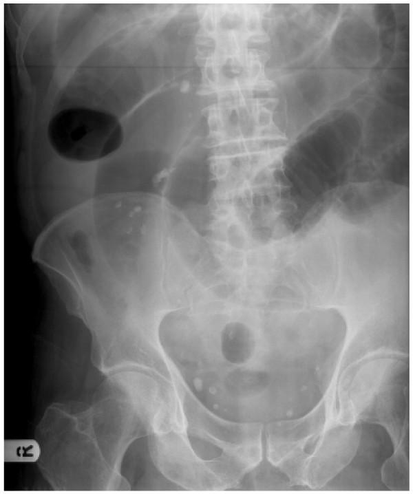 https://cdn.ncbi.nlm.nih.gov/pmc/blobs/7f7d/1847829/d47a4efeb665/1752-1947-1-8-1.jpg