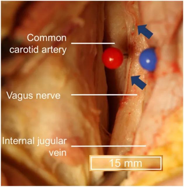https://cdn.ncbi.nlm.nih.gov/pmc/blobs/7f81/7199464/238b7712877a/fnins-14-00284-g0003.jpg