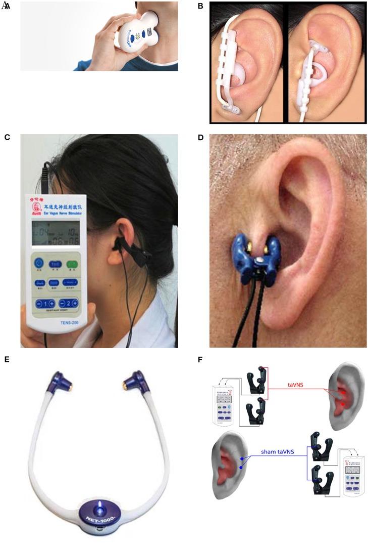 https://cdn.ncbi.nlm.nih.gov/pmc/blobs/7f81/7199464/47a2474af152/fnins-14-00284-g0005.jpg