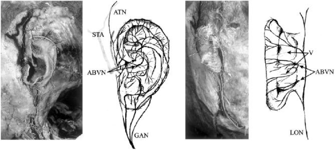 https://cdn.ncbi.nlm.nih.gov/pmc/blobs/7f81/7199464/de3f6b0dd94c/fnins-14-00284-g0002.jpg