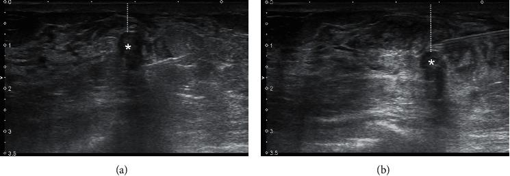 https://cdn.ncbi.nlm.nih.gov/pmc/blobs/7f81/9187288/1e400250deff/TBJ2022-1888726.001.jpg