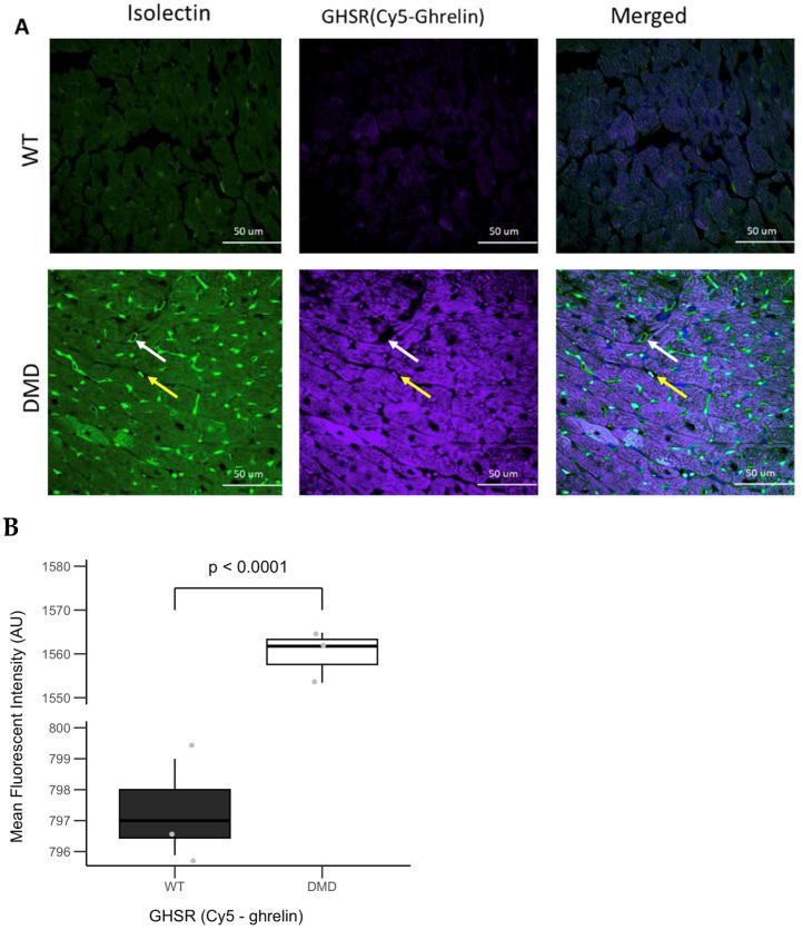 https://cdn.ncbi.nlm.nih.gov/pmc/blobs/7f86/12249256/203b72c74a89/cells-14-01002-g006.jpg