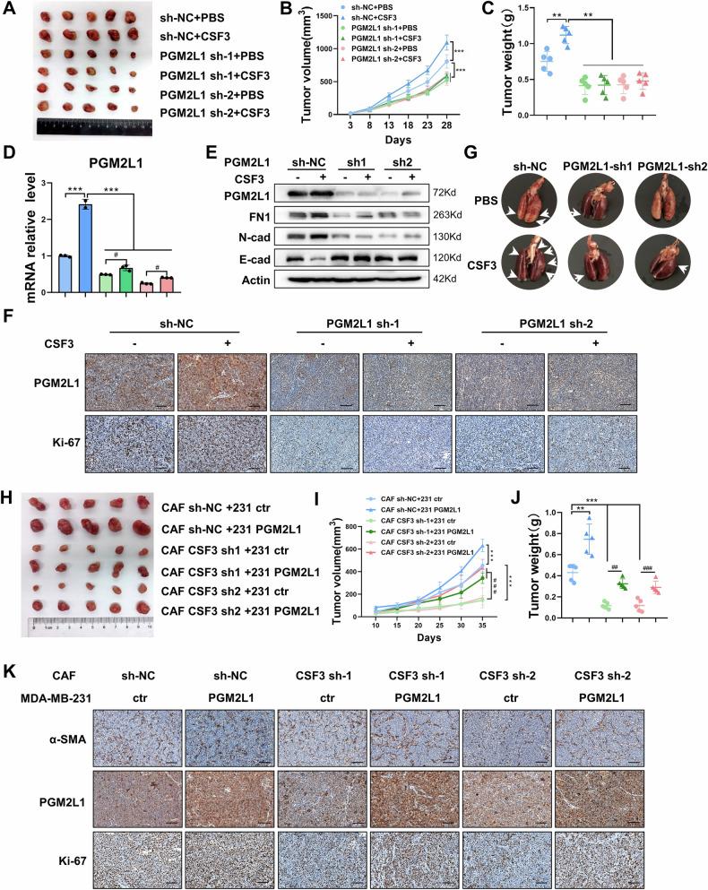 https://cdn.ncbi.nlm.nih.gov/pmc/blobs/7f8a/11971334/63bf3cdce1da/41419_2025_7580_Fig7_HTML.jpg