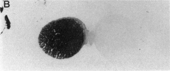 https://cdn.ncbi.nlm.nih.gov/pmc/blobs/7f8d/1298376/1a0b09c78684/taos00004-0605-b.jpg