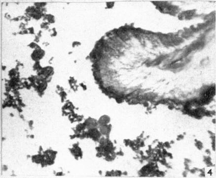 https://cdn.ncbi.nlm.nih.gov/pmc/blobs/7fa0/1244422/8d3f35a8e97e/janat00439-0176-d.jpg