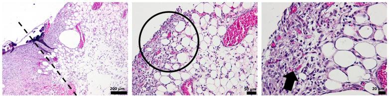 https://cdn.ncbi.nlm.nih.gov/pmc/blobs/7fa1/10057140/7a31aa1b7e38/pharmaceutics-15-00857-g012.jpg