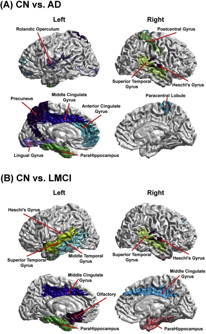 https://cdn.ncbi.nlm.nih.gov/pmc/blobs/7fa6/6627731/d6cb3f0424a4/gr6.jpg