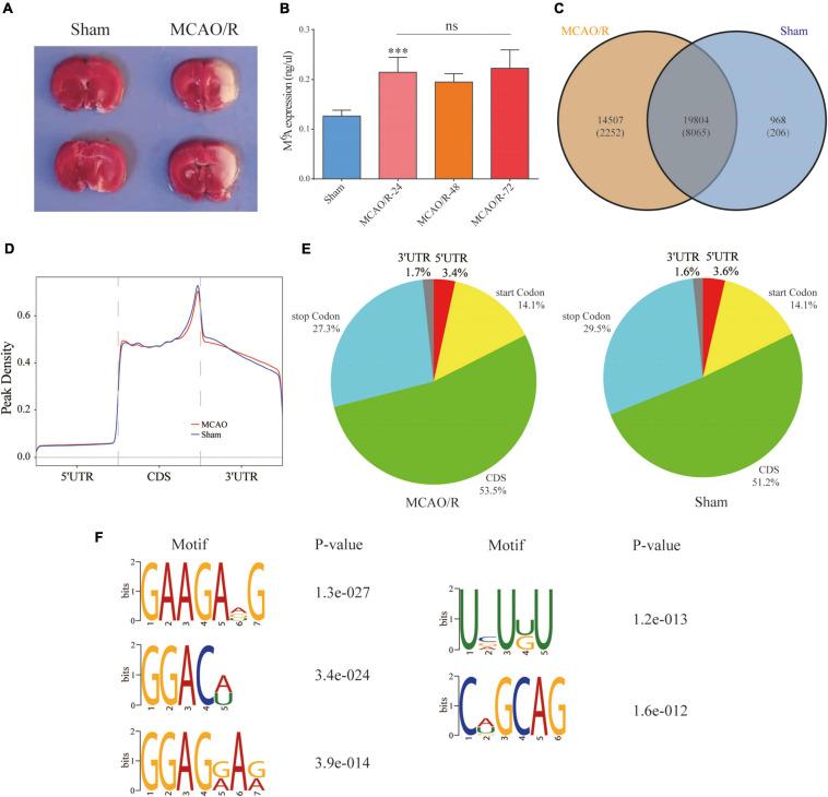 https://cdn.ncbi.nlm.nih.gov/pmc/blobs/7fb3/8009187/c1328cacfc2d/fnins-15-605654-g002.jpg