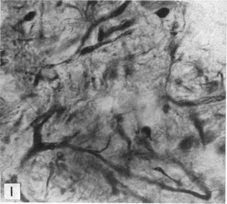 https://cdn.ncbi.nlm.nih.gov/pmc/blobs/7fb6/1252630/740d7e6cf219/janat00517-0068-a.jpg