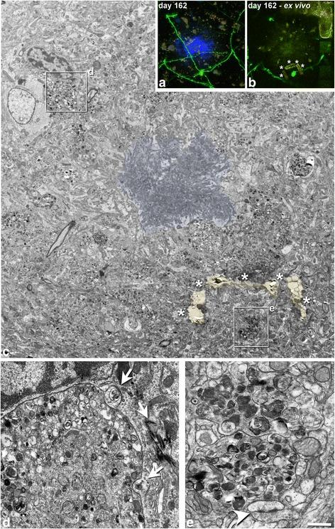 https://cdn.ncbi.nlm.nih.gov/pmc/blobs/7fb7/5296955/331b517892df/40478_2017_415_Fig7_HTML.jpg