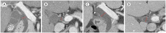 https://cdn.ncbi.nlm.nih.gov/pmc/blobs/7fba/11166583/d5fd5b1c1a49/jksr-85-581-g003.jpg
