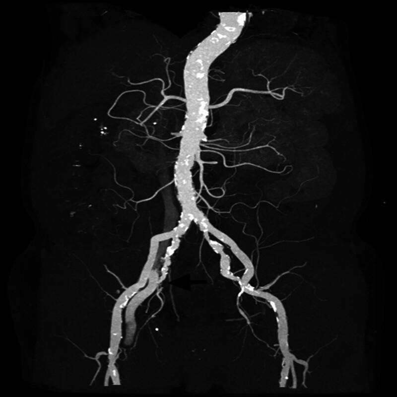 https://cdn.ncbi.nlm.nih.gov/pmc/blobs/7fbb/11749577/fb347678d5c3/medi-104-e41281-g001.jpg