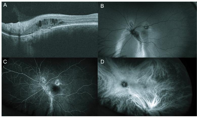https://cdn.ncbi.nlm.nih.gov/pmc/blobs/7fbf/10172805/5882ae023a39/jovr-18-212-g004.jpg