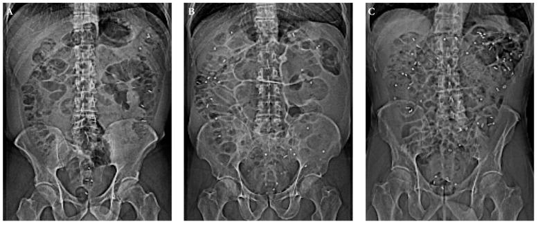 https://cdn.ncbi.nlm.nih.gov/pmc/blobs/7fc0/7866791/5cb8b36adabc/jcm-10-00493-g002.jpg