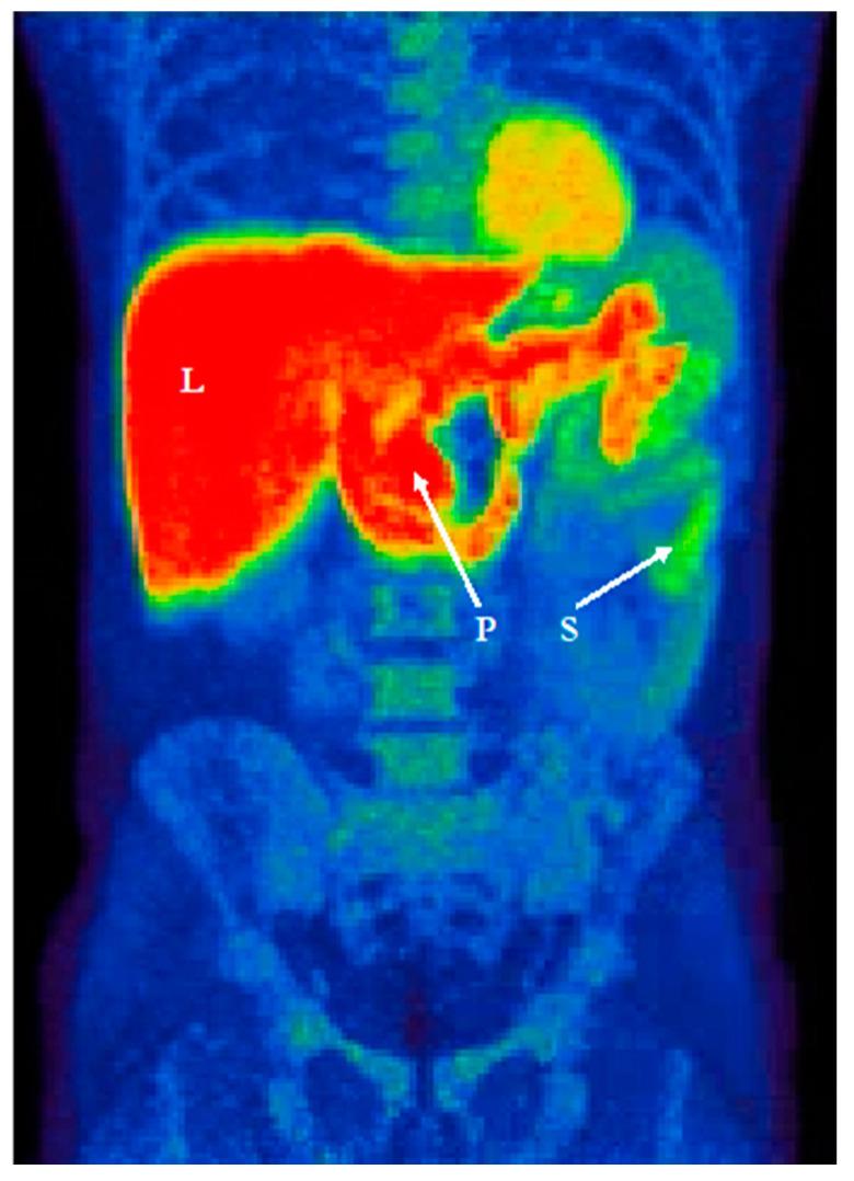 https://cdn.ncbi.nlm.nih.gov/pmc/blobs/7fc0/7866791/ed0f2daebe1a/jcm-10-00493-g003.jpg