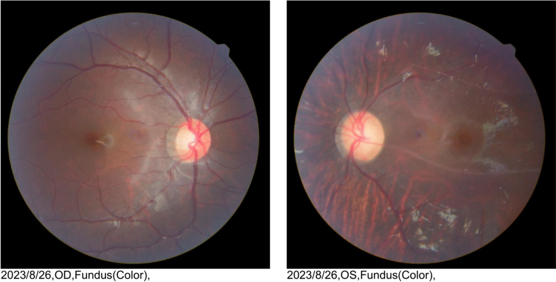 https://cdn.ncbi.nlm.nih.gov/pmc/blobs/7fc8/11834293/762d17760373/12886_2025_3910_Fig2_HTML.jpg