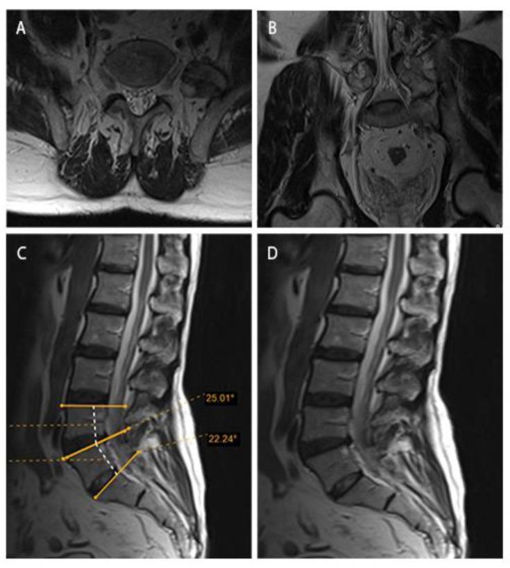 https://cdn.ncbi.nlm.nih.gov/pmc/blobs/7fc8/12232574/1600839f2262/ABJS-13-271-g004.jpg