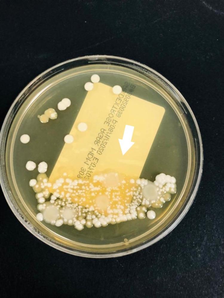 https://cdn.ncbi.nlm.nih.gov/pmc/blobs/7fd7/8224536/38898cba7a8b/cureus-0013-00000015240-i01.jpg