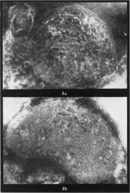 https://cdn.ncbi.nlm.nih.gov/pmc/blobs/7feb/2072148/e1885e48734f/brjexppathol00434-0126-a.jpg