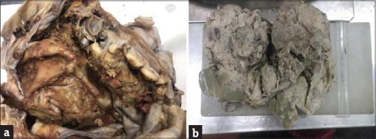 https://cdn.ncbi.nlm.nih.gov/pmc/blobs/7fee/9583363/442670b9b772/JMH-13-190-g002.jpg