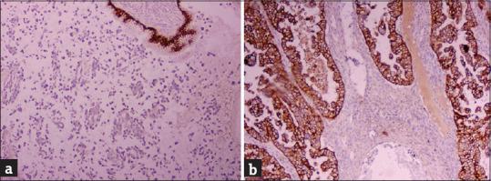 https://cdn.ncbi.nlm.nih.gov/pmc/blobs/7fee/9583363/f7486e950412/JMH-13-190-g004.jpg