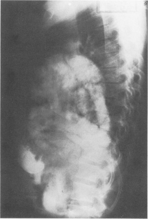 https://cdn.ncbi.nlm.nih.gov/pmc/blobs/7ff0/1396746/4a93abbaad95/annsurg00355-0116-a.jpg