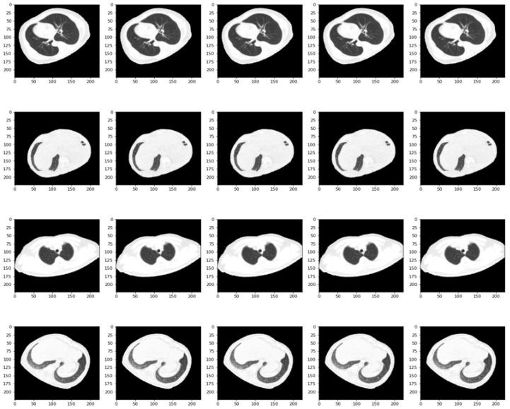 https://cdn.ncbi.nlm.nih.gov/pmc/blobs/7ff2/10813639/7ddb0c853f6d/bioengineering-11-00079-g004.jpg