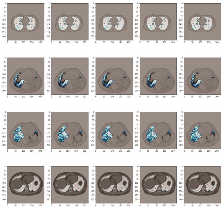 https://cdn.ncbi.nlm.nih.gov/pmc/blobs/7ff2/10813639/9aa72cf6e307/bioengineering-11-00079-g011.jpg
