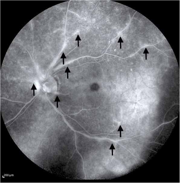 https://cdn.ncbi.nlm.nih.gov/pmc/blobs/7ff3/8864036/b985af081ac3/12348_2022_286_Fig3_HTML.jpg