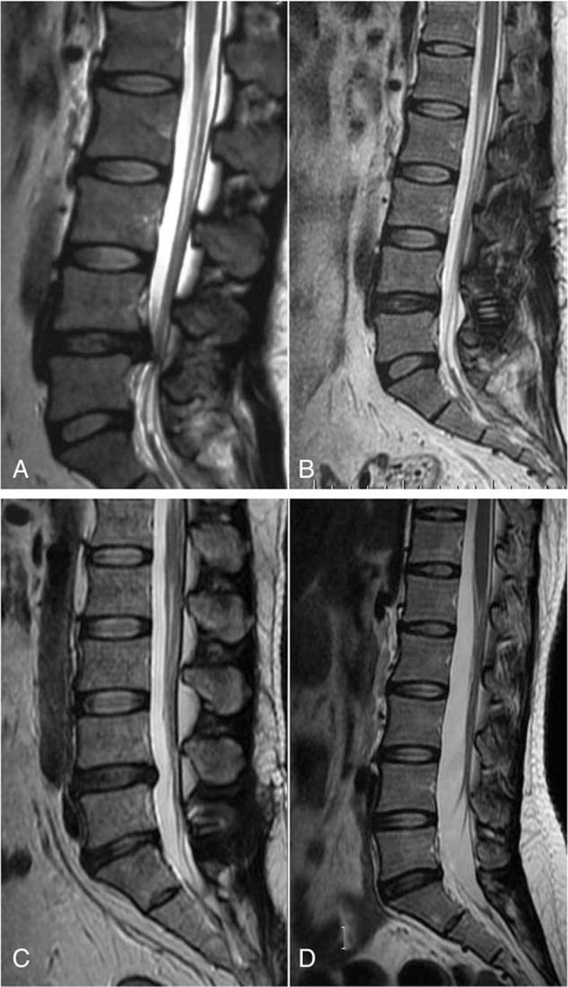 https://cdn.ncbi.nlm.nih.gov/pmc/blobs/7ff4/5459735/2de1641b4e8d/medi-96-e7056-g007.jpg