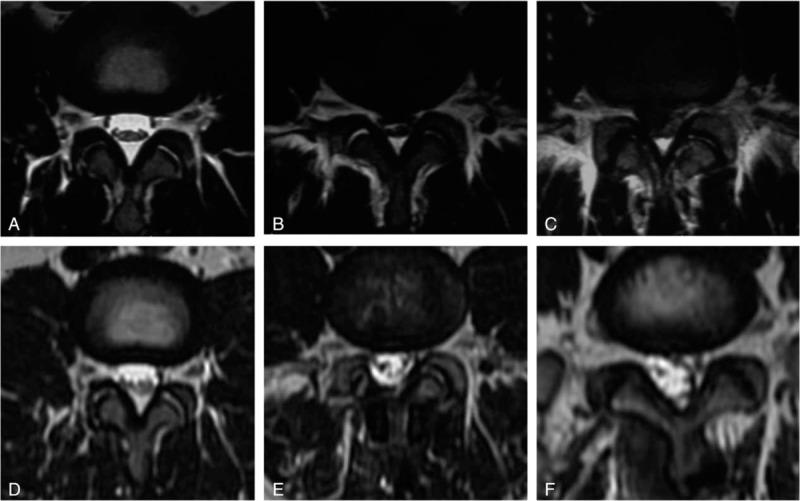 https://cdn.ncbi.nlm.nih.gov/pmc/blobs/7ff4/5459735/810d065350c9/medi-96-e7056-g008.jpg