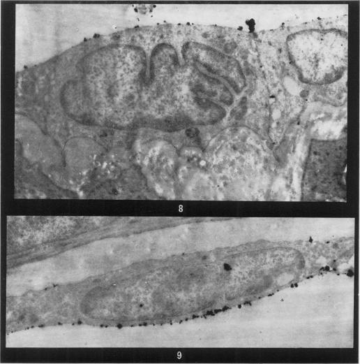 https://cdn.ncbi.nlm.nih.gov/pmc/blobs/7ff5/2072717/5210237bd17a/brjexppathol00397-0070-a.jpg