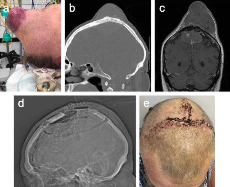 https://cdn.ncbi.nlm.nih.gov/pmc/blobs/7ffa/11126431/183d8f32e8dc/701_2024_6126_Fig2_HTML.jpg