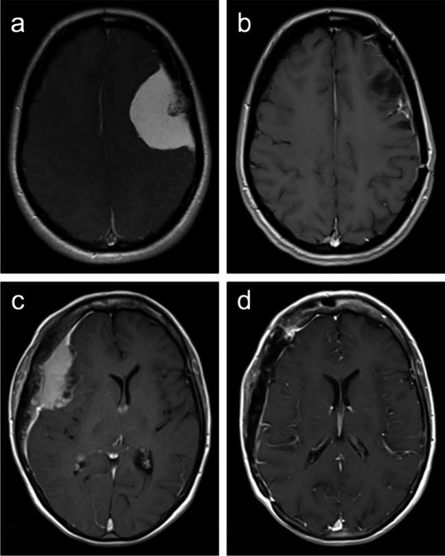 https://cdn.ncbi.nlm.nih.gov/pmc/blobs/7ffa/11126431/596ba54a4080/701_2024_6126_Fig1_HTML.jpg
