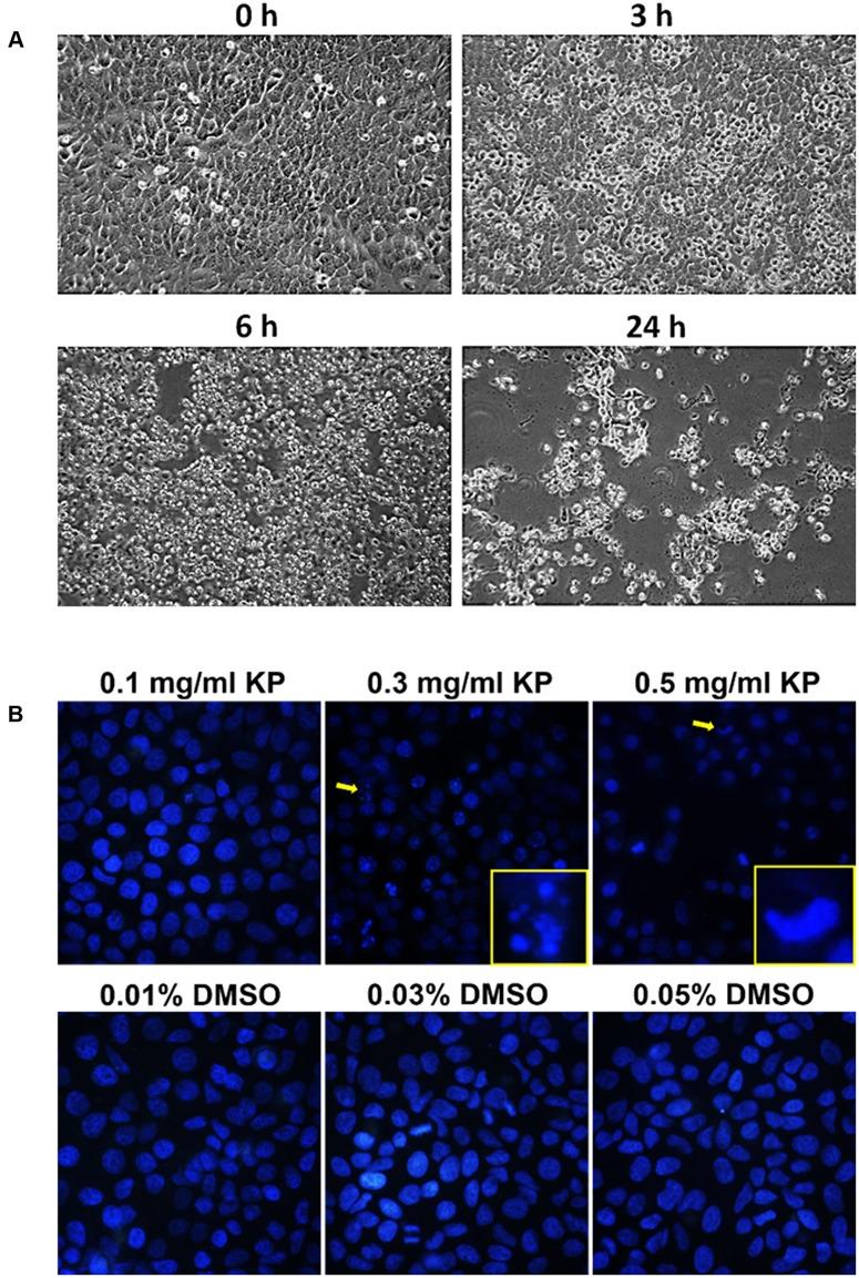 https://cdn.ncbi.nlm.nih.gov/pmc/blobs/7ffd/5600991/137934dd7a75/fphar-08-00630-g002.jpg