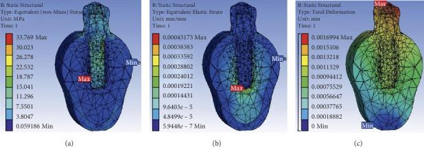 https://cdn.ncbi.nlm.nih.gov/pmc/blobs/7ffe/7229563/2cecd2a94c33/TSWJ2020-2363298.003.jpg
