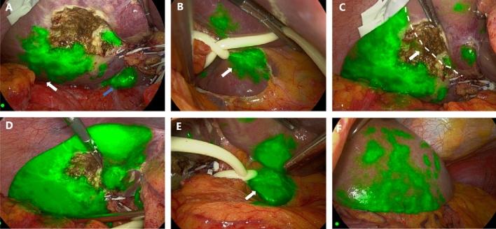 https://cdn.ncbi.nlm.nih.gov/pmc/blobs/8000/10824724/18b3f357d50a/41598_2024_52904_Fig5_HTML.jpg